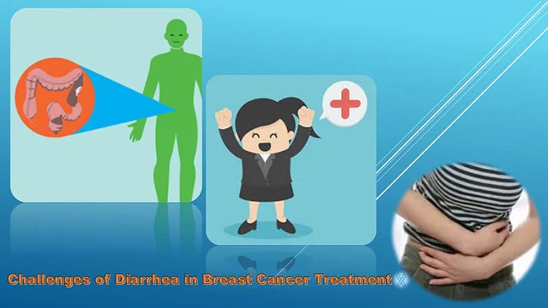 Diarrhea-in-Breast-Cancer-Treatment Diarrhea in Breast Cancer Treatment