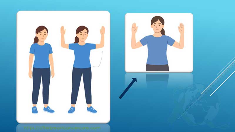 Woman demonstrating the “arm lift to shoulder level” exercise after breast cancer surgery, showing arms slowly raised to improve shoulder mobility and lymphatic flow.