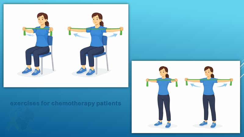 Arm opening exercise with resistance band, part of safe exercises for chemotherapy patients